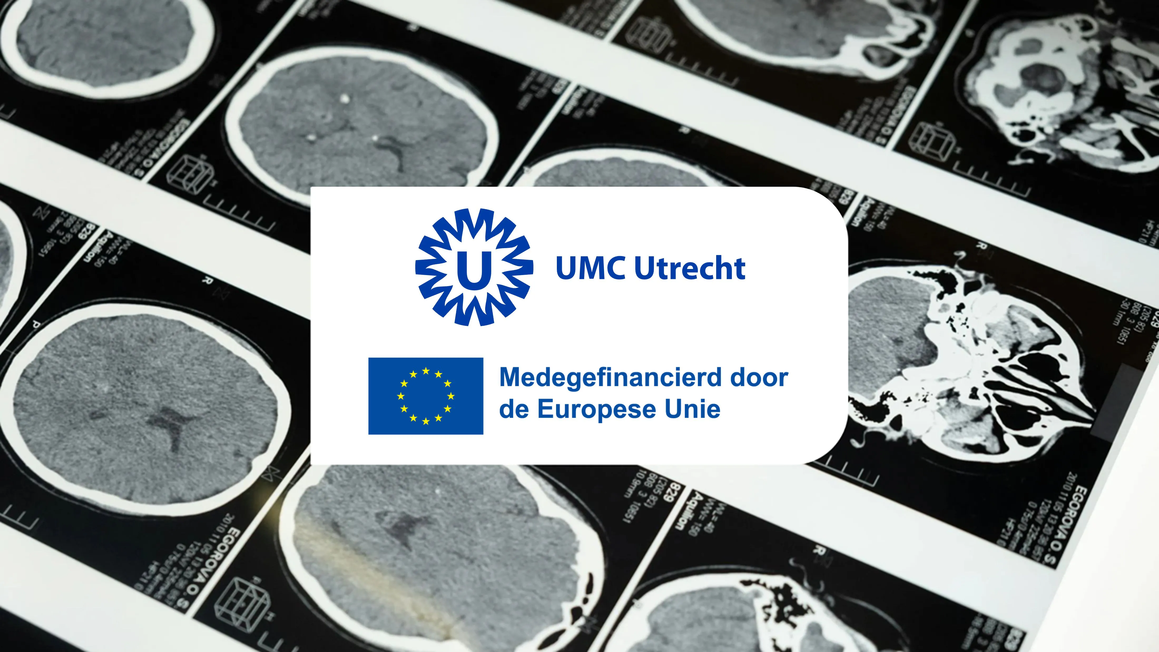 UMCU